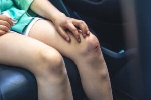 laceration treatment Katy TX